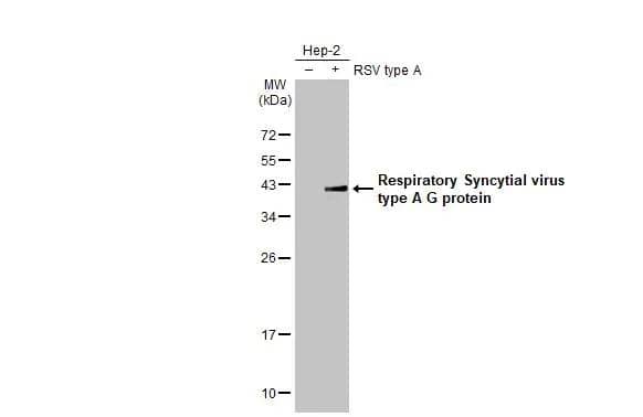 Non-infected (-) and infected (+) HEp-2 whole cell extracts (5 ug) were separated by 12% SDS-PAGE, and the membrane was blotted with Respiratory Syncytial Virus Glycoprotein G antibody [HL2354] (NBP3-25631) diluted at 1:1000. The HRP-conjugated anti-rabbit IgG antibody was used to detect the primary antibody, and the signal was developed with Trident ECL plus-Enhanced. 