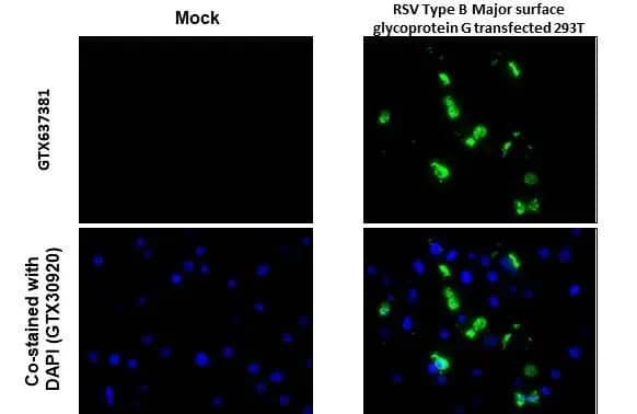 Immunohistochemistry-Paraffin Respiratory Syncytial Virus Glycoprotein G Antibody (HL1733) - Azide and BSA Free