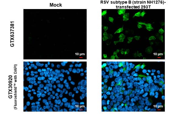 Immunocytochemistry/ Immunofluorescence Respiratory Syncytial Virus Glycoprotein G Antibody (HL1733) - Azide and BSA Free