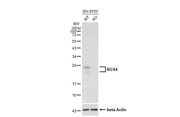 Knockout Validated: RGS4 Antibody (HL1522) - Azide and BSA Free [NBP3-25636] - Unboiled wild-type (WT) and RGS4 knockout (KO) SH-SY5Y cell extracts (15 ug) were separated by 12% SDS-PAGE, and the membrane was blotted with RGS4 antibody [HL1522] (NBP3-25636) diluted at 1:1000. The HRP-conjugated anti-rabbit IgG antibody was used to detect the primary antibody.