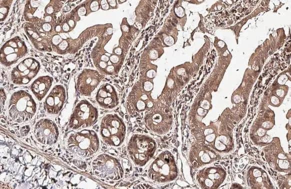 Immunohistochemistry-Paraffin: RGS4 Antibody (HL1522) - Azide and BSA Free [NBP3-25636] - RGS4 antibody [HL1522] detects RGS4 protein at cell membrane and nucleus by immunohistochemical analysis. Sample: Paraffin-embedded rat intestine. RGS4 stained by RGS4 antibody [HL1522] (NBP3-25636) diluted at 1:100. Antigen Retrieval: Citrate buffer, pH 6.0, 15 min