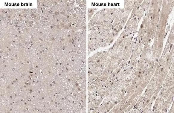 Immunohistochemistry-Paraffin: RGS4 Antibody (HL1522) - Azide and BSA Free [NBP3-25636] - RGS4 antibody [HL1522] detects RGS4 protein by immunohistochemical analysis. Sample: Paraffin-embedded mouse tissues. RGS4 stained by RGS4 antibody [HL1522] (NBP3-25636) diluted at 1:100. Antigen Retrieval: Citrate buffer, pH 6.0, 15 min