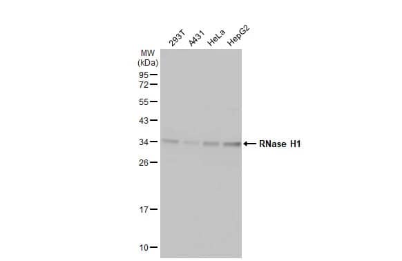 Western Blot: RNase H1 Antibody (HL2343) - Azide and BSA Free [NBP3-25638] - Various whole cell extracts (30 ug) were separated by 12% SDS-PAGE, and the membrane was blotted with RNase H1 antibody [HL2343] (NBP3-25638) diluted at 1:1000. The HRP-conjugated anti-rabbit IgG antibody was used to detect the primary antibody.