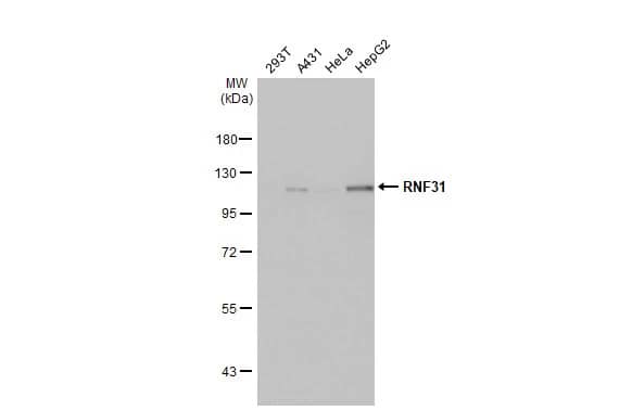 Western Blot: HOIP/RNF31 Antibody (HL2295) - Azide and BSA Free [NBP3-25641] - Various whole cell extracts (30 ug) were separated by 7.5% SDS-PAGE, and the membrane was blotted with RNF31 antibody [HL2295] (NBP3-25641) diluted at 1:10000. The HRP-conjugated anti-rabbit IgG antibody was used to detect the primary antibody.