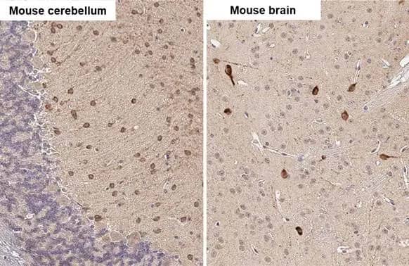 Immunohistochemistry-Paraffin: HOIP/RNF31 Antibody (HL2295) - Azide and BSA Free [NBP3-25641] - RNF31 antibody [HL2295] detects RNF31 protein by immunohistochemical analysis. Sample: Paraffin-embedded mouse tissues. RNF31 stained by RNF31 antibody [HL2295] (NBP3-25641) diluted at 1:100. Antigen Retrieval: Citrate buffer, pH 6.0, 15 min