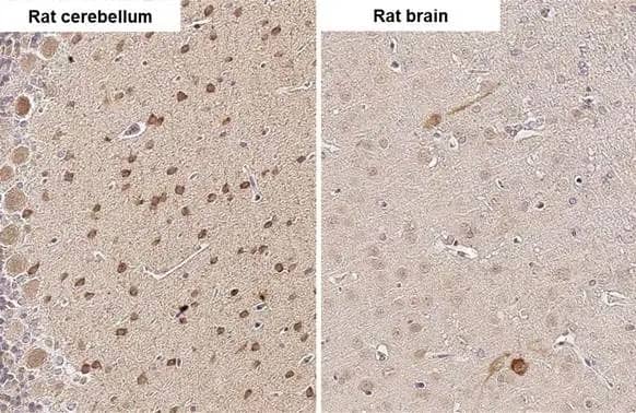 Immunohistochemistry-Paraffin: HOIP/RNF31 Antibody (HL2295) - Azide and BSA Free [NBP3-25641] - RNF31 antibody [HL2295] detects RNF31 protein by immunohistochemical analysis. Sample: Paraffin-embedded rat tissues. RNF31 stained by RNF31 antibody [HL2295] (NBP3-25641) diluted at 1:100. Antigen Retrieval: Citrate buffer, pH 6.0, 15 min