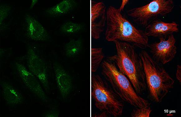 ROCK1/2 antibody [HL1632] detects ROCK1/2 protein at Golgi apparatus and cytoplasm by immunofluorescent analysis.Sample: HeLa cells were fixed in 4% paraformaldehyde at RT for 15 min.Green: ROCK1/2 stained by ROCK1/2 antibody [HL1632] (NBP3-25642) diluted at 1:500.Red: alpha Tubulin, a cytoskeleton marker, stained by alpha Tubulin antibody [GT114] diluted at 1:1000.Blue: Fluoroshield with DAPI . 