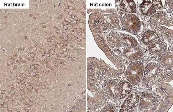 ROCK1/2 antibody [HL1632] detects ROCK1/2 protein by immunohistochemical analysis.Sample: Paraffin-embedded rat tissues.ROCK1/2 stained by ROCK1/2 antibody [HL1632] (NBP3-25642) diluted at 1:200.Antigen Retrieval: Citrate buffer, pH 6.0, 15 min 