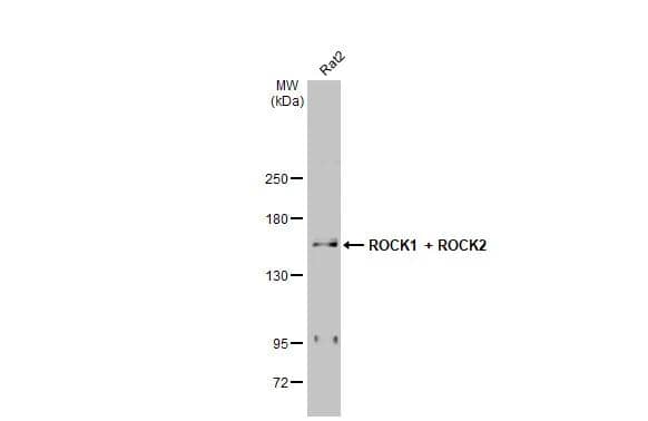 Whole cell extract (30 ug) was separated by 5% SDS-PAGE, and the membrane was blotted with ROCK1/2 antibody [HL1632] (NBP3-25642) diluted at 1:1000. The HRP-conjugated anti-rabbit IgG antibody was used to detect the primary antibody. 