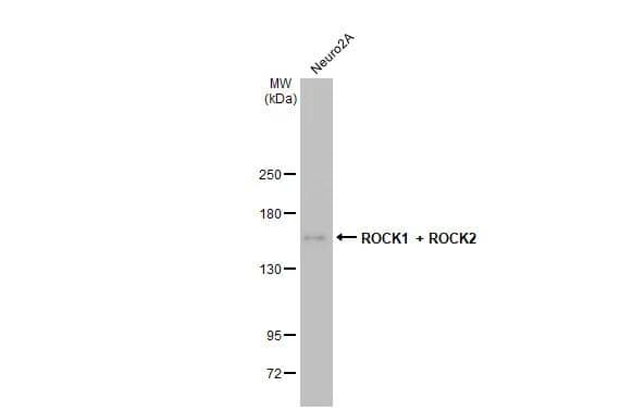 Whole cell extract (30 ug) was separated by 5% SDS-PAGE, and the membrane was blotted with ROCK1/2 antibody [HL1632] (NBP3-25642) diluted at 1:1000. The HRP-conjugated anti-rabbit IgG antibody was used to detect the primary antibody. 