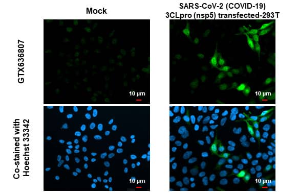 Immunocytochemistry/Immunofluorescence: SARS-CoV-2 3CL Protease Antibody (HL1367) - Azide and BSA Free [NBP3-25645] - SARS-CoV-2 (COVID-19) 3CLpro (nsp5) antibody [HL1367] detects SARS-CoV-2 (COVID-19) 3CLpro (nsp5) protein by immunofluorescent analysis. Sample: Mock and transfected 293T cells were fixed in 4% paraformaldehyde at RT for 15 min. Green: SARS-CoV-2 (COVID-19) 3CLpro (nsp5) stained by SARS-CoV-2 (COVID-19) 3CLpro (nsp5) antibody [HL1367] (NBP3-25645) diluted at 1:500. Blue: Hoechst 33342 staining.