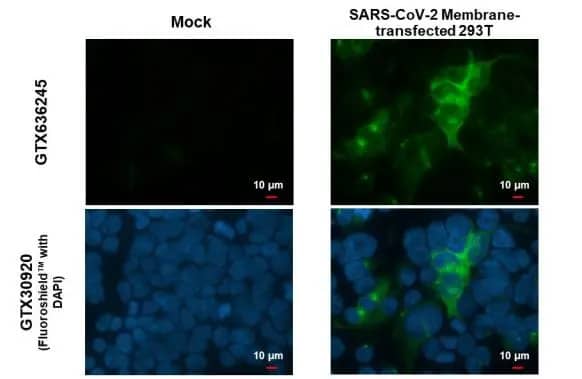 Immunocytochemistry/Immunofluorescence: SARS-CoV-2 Membrane Protein Antibody (HL1087) - Azide and BSA Free [NBP3-25647] - SARS-CoV-2 (COVID-19) Membrane antibody [HL1087] detects SARS-CoV-2 (COVID-19) Membrane protein by immunofluorescent analysis. Sample: 293T cells were fixed in 4% paraformaldehyde at RT for 15 min. Green: SARS-CoV-2 (COVID-19) Membrane stained by SARS-CoV-2 (COVID-19) Membrane antibody [HL1087] (NBP3-25647) diluted at 1:2000. Blue: Fluoroshield with DAPI .