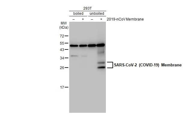 Western Blot: SARS-CoV-2 Membrane Protein Antibody (HL1088) - Azide and BSA Free [NBP3-25648] - Non-transfected (-) and transfected (+) 293T whole cell extracts (30 ug) were separated by 12% SDS-PAGE, and the membrane was blotted with SARS-CoV-2 (COVID-19) Membrane antibody [HL1088] (NBP3-25648) diluted at 1:20000. The HRP-conjugated anti-rabbit IgG antibody was used to detect the primary antibody.