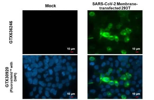 Immunocytochemistry/Immunofluorescence: SARS-CoV-2 Membrane Protein Antibody (HL1088) - Azide and BSA Free [NBP3-25648] - SARS-CoV-2 (COVID-19) Membrane antibody [HL1088] detects SARS-CoV-2 (COVID-19) Membrane protein by immunofluorescent analysis. Sample: 293T cells were fixed in 4% paraformaldehyde at RT for 15 min. Green: SARS-CoV-2 (COVID-19) Membrane stained by SARS-CoV-2 (COVID-19) Membrane antibody [HL1088] (NBP3-25648) diluted at 1:2000. Blue: Fluoroshield with DAPI .