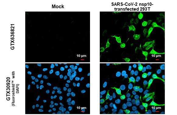 Immunocytochemistry/Immunofluorescence: SARS-CoV-2 NSP10 Antibody (HL1381) - Azide and BSA Free [NBP3-25650] - SARS-CoV-2 (COVID-19) nsp10 antibody [HL1381] detects SARS-CoV-2 (COVID-19) nsp10 protein at cytoplasm and nucleus by immunofluorescent analysis. Sample: Mock and transfected 293T cells were fixed in 4% paraformaldehyde at RT for 15 min. Green: SARS-CoV-2 (COVID-19) nsp10 stained by SARS-CoV-2 (COVID-19) nsp10 antibody [HL1381] (NBP3-25650) diluted at 1:500. Blue: Fluoroshield with DAPI . Scale bar= 10um.