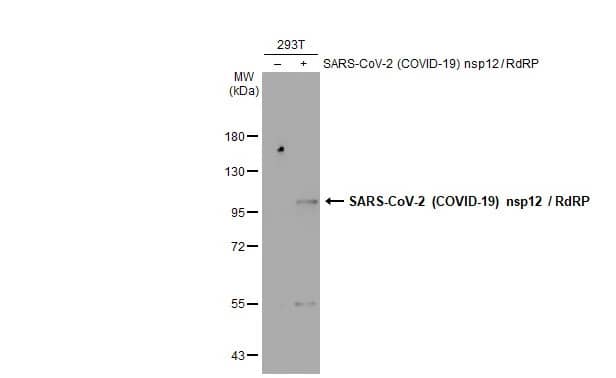 Western Blot: SARS-CoV-2 nsp12 Antibody - Azide and BSA Free [NBP3-25652] - Non-transfected (-) and transfected (+) 293T whole cell extracts (30 ug) were separated by 7.5% SDS-PAGE, and the membrane was blotted with SARS-CoV-2 (COVID-19) nsp12 / RdRP antibody (NBP3-25652) diluted at 1:5000. The HRP-conjugated anti-rabbit IgG antibody was used to detect the primary antibody.