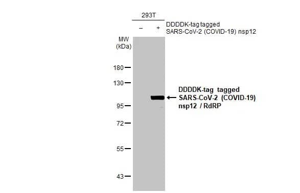 Western Blot: SARS-CoV-2 nsp12 Antibody (HL1444) - Azide and BSA Free [NBP3-25653] - Non-transfected (-) and transfected (+) 293T whole cell extracts (30 ug) were separated by 7.5% SDS-PAGE, and the membrane was blotted with SARS-CoV-2 (COVID-19) nsp12 / RdRP antibody [HL1444] (NBP3-25653) diluted at 1:5000. The HRP-conjugated anti-rabbit IgG antibody was used to detect the primary antibody.