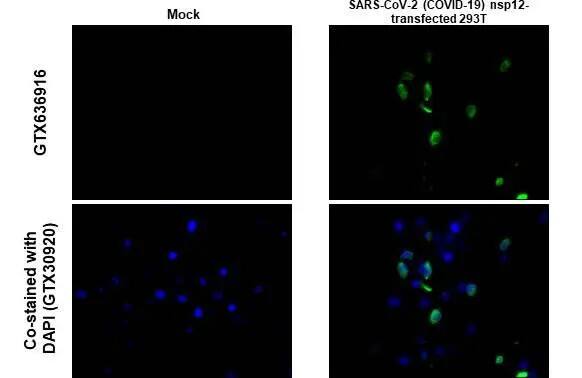 Immunohistochemistry-Paraffin: SARS-CoV-2 nsp12 Antibody (HL1444) - Azide and BSA Free [NBP3-25653] - SARS-CoV-2 nsp12 detects SARS-CoV-2 nsp12 protein at cytoplasm by immunohistochemical analysis. Sample: human SARS-CoV-2 (COVID-19) Nucleocapsid transfected 293T cell FFPE Cell Pellet Block . Green: SARS-CoV-2 nsp12 stained by SARS-CoV-2 nsp12 (NBP3-25653) diluted at 1:255. Blue: Fluoroshield with DAPI . Antigen Retrieval: Citrate buffer, pH 6.0, 15 min