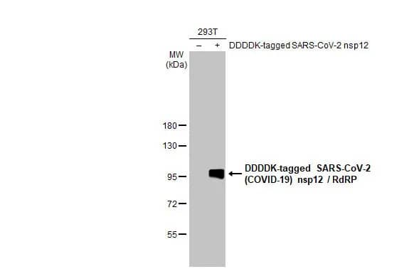 Western Blot: SARS-CoV-2 nsp12 Antibody (HL2221) - Azide and BSA Free [NBP3-25654] - Non-transfected (-) and transfected (+) 293T whole cell extracts (30 ug) were separated by 7.5% SDS-PAGE, and the membrane was blotted with SARS-CoV-2 (COVID-19) nsp12 / RdRP antibody [HL2221] (NBP3-25654) diluted at 1:5000. The HRP-conjugated anti-rabbit IgG antibody was used to detect the primary antibody.
