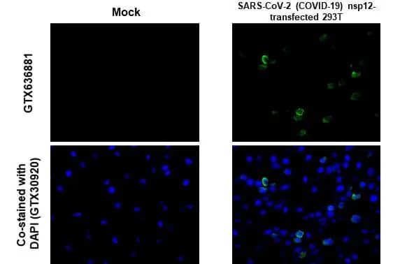 Immunohistochemistry-Paraffin: SARS-CoV-2 nsp12 Antibody (HL1415) - Azide and BSA Free [NBP3-25655] - SARS-CoV-2 (COVID-19) nsp12 antibody [HL1415] detects SARS-CoV-2 (COVID-19) nsp12 protein by immunohistochemical analysis. Sample: SARS-CoV-2 (COVID-19) nsp12 transfected 293T cell FFPE Cell Pellet Block. Green: SARS-CoV-2 (COVID-19) nsp12 stained by SARS-CoV-2 (COVID-19) nsp12 antibody [HL1415] (NBP3-25655) diluted at 1:100. Blue: Fluoroshield with DAPI . Antigen Retrieval: Citrate buffer, pH 6.0, 15 min