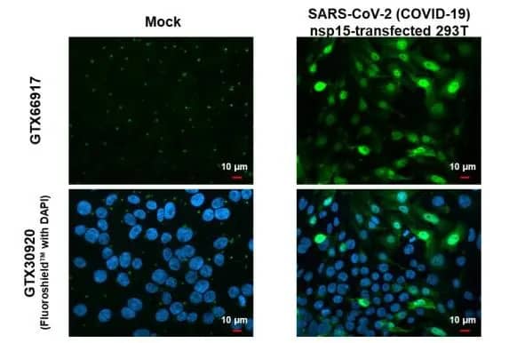 Immunocytochemistry/Immunofluorescence: SARS-CoV-2 nsp15 Antibody (HL1445) - Azide and BSA Free [NBP3-25656] - SARS-CoV-2 (COVID-19) nsp15 antibody [HL1445] detects SARS-CoV-2 (COVID-19) nsp15 protein by immunofluorescent analysis. Sample: Mock and transfected 293T cells were fixed in 4% paraformaldehyde at RT for 15 min. Green: SARS-CoV-2 (COVID-19) nsp15 stained by SARS-CoV-2 (COVID-19) nsp15 antibody [HL1445] (NBP3-25656) diluted at 1:1000. Blue: Fluoroshield with DAPI .