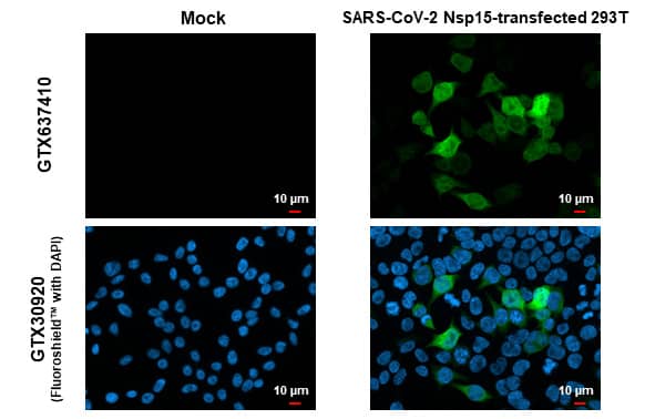Immunocytochemistry/Immunofluorescence: SARS-CoV-2 nsp15 Antibody (HL1760) - Azide and BSA Free [NBP3-25658] - SARS-CoV-2 (COVID-19) nsp15 antibody [HL1760] detects SARS-CoV-2 (COVID-19) nsp15 protein by immunofluorescent analysis. Sample: Mock and transfected 293T cells were fixed in 4% paraformaldehyde at RT for 15 min. Green: SARS-CoV-2 (COVID-19) nsp15 stained by SARS-CoV-2 (COVID-19) nsp15 antibody [HL1760] (NBP3-25658) diluted at 1:500. Blue: Fluoroshield with DAPI .