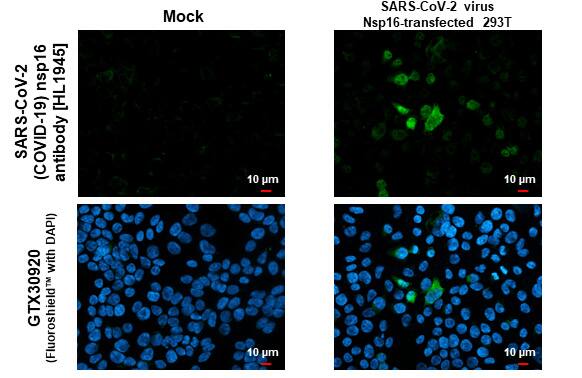 Immunocytochemistry/Immunofluorescence: SARS-CoV-2 nsp16 Antibody (HL1945) - Azide and BSA Free [NBP3-25660] - SARS-CoV-2 (COVID-19) nsp16 antibody [HL1945] detects SARS-CoV-2 (COVID-19) nsp16 protein by immunofluorescent analysis. Sample: Mock and transfected 293T cells were fixed in 4% paraformaldehyde at RT for 15 min. Green: SARS-CoV-2 (COVID-19) nsp16 stained by SARS-CoV-2 (COVID-19) nsp16 antibody [HL1945] (NBP3-25660) diluted at 1:500. Blue: Fluoroshield with DAPI .