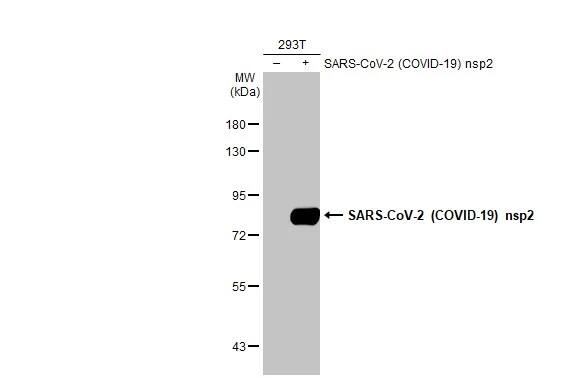 Western Blot: SARS-CoV-2 nsp2 Antibody (HL1371) - Azide and BSA Free [NBP3-25661] - Non-transfected (-) and transfected (+) 293T whole cell extracts (30 ug) were separated by 7.5% SDS-PAGE, and the membrane was blotted with SARS-CoV-2 (COVID-19) nsp2 antibody [HL1371] (NBP3-25661) diluted at 1:5000. The HRP-conjugated anti-rabbit IgG antibody was used to detect the primary antibody.