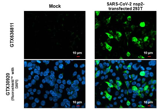 Immunocytochemistry/Immunofluorescence: SARS-CoV-2 nsp2 Antibody (HL1371) - Azide and BSA Free [NBP3-25661] - SARS-CoV-2 (COVID-19) nsp2 antibody [HL1371] detects SARS-CoV-2 (COVID-19) nsp2 protein at cytoplasm by immunofluorescent analysis. Sample: Mock and transfected 293T cells were fixed in 4% paraformaldehyde at RT for 15 min. Green: SARS-CoV-2 (COVID-19) nsp2 stained by SARS-CoV-2 (COVID-19) nsp2 antibody [HL1371] (NBP3-25661) diluted at 1:500. Blue: Fluoroshield with DAPI . Scale bar= 10um.