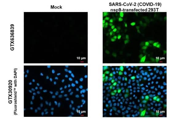 Immunocytochemistry/Immunofluorescence: SARS-CoV-2 nsp9 Antibody (HL1399) - Azide and BSA Free [NBP3-25665] - SARS-CoV-2 (COVID-19) nsp9 antibody [HL1399] detects SARS-CoV-2 (COVID-19) nsp9 protein by immunofluorescent analysis. Sample: Mock and transfected 293T cells were fixed in 4% paraformaldehyde at RT for 15 min. Green: SARS-CoV-2 (COVID-19) nsp9 stained by SARS-CoV-2 (COVID-19) nsp9 antibody [HL1399] (NBP3-25665) diluted at 1:500. Blue: Fluoroshield with DAPI .