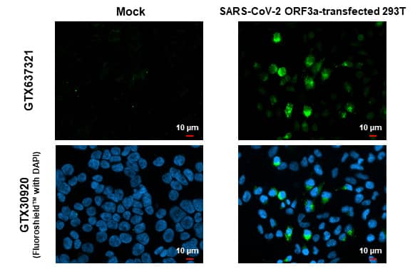 Immunocytochemistry/Immunofluorescence: SARS-CoV-2 ORF3a Antibody (HL1722) - Azide and BSA Free [NBP3-25666] - SARS-CoV-2 (COVID-19) ORF3a antibody [HL1722] detects SARS-CoV-2 (COVID-19) ORF3a protein by immunofluorescent analysis. Sample: Mock and transfected 293T cells were fixed in 4% paraformaldehyde at RT for 15 min. Green: SARS-CoV-2 (COVID-19) ORF3a stained by SARS-CoV-2 (COVID-19) ORF3a antibody [HL1722] (NBP3-25666) diluted at 1:500. Blue: Fluoroshield with DAPI .