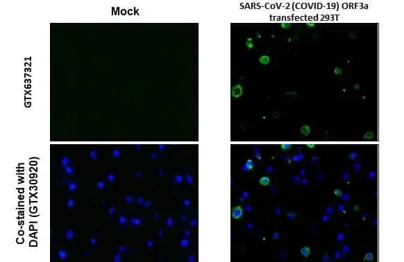 Immunohistochemistry-Paraffin: SARS-CoV-2 ORF3a Antibody (HL1722) - Azide and BSA Free [NBP3-25666] - SARS-CoV-2 (COVID-19) ORF3a antibody [HL1722] detects SARS-CoV-2 (COVID-19) ORF3a protein by immunohistochemical analysis. Sample: Paraffin-embedded mock and SARS-CoV-2 (COVID-19) ORF3a transfected 293T. Green: SARS-CoV-2 (COVID-19) ORF3a stained by SARS-CoV-2 (COVID-19) ORF3a antibody [HL1722] (NBP3-25666) diluted at 1:1000. Blue: Fluoroshield with DAPI . Antigen Retrieval: Citrate buffer, pH 6.0, 15 min