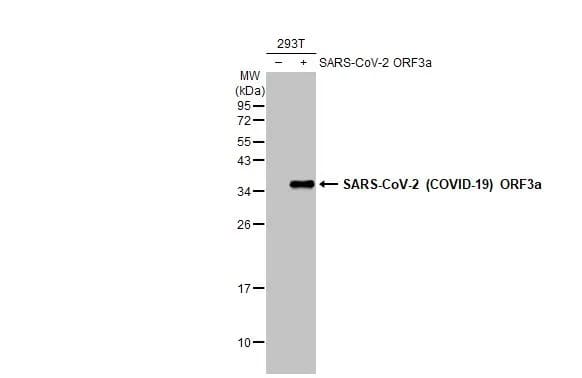 Western Blot: SARS-CoV-2 ORF3a Antibody (HL1722) - Azide and BSA Free [NBP3-25666] - Non-transfected (-) and transfected (+) 293T whole cell extracts (30 ug) were separated by 12% SDS-PAGE, and the membrane was blotted with SARS-CoV-2 (COVID-19) ORF3a antibody [HL1722] (NBP3-25666) diluted at 1:5000. The HRP-conjugated anti-rabbit IgG antibody was used to detect the primary antibody.