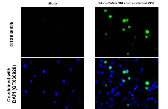 Immunohistochemistry-Paraffin: SARS-CoV-2 ORF7b Antibody (HL1453) - Azide and BSA Free [NBP3-25667] - SARS-CoV-2 (COVID-19) ORF7b antibody [HL1453] detects SARS-CoV-2 (COVID-19) ORF7b protein at cytoplasm by immunohistochemical analysis. Sample: Paraffin-embedded mock and SARS-CoV-2 ORF7b transfected 293T cell pellet. Green: SARS-CoV-2 (COVID-19) ORF7b stained by SARS-CoV-2 (COVID-19) ORF7b antibody [HL1453] (NBP3-25667) diluted at 1:1000. Blue: Fluoroshield with DAPI . Antigen Retrieval: Citrate buffer, pH 6.0, 15 min