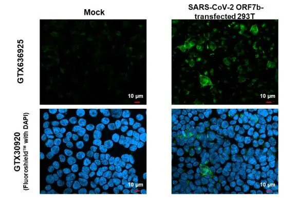 Immunocytochemistry/Immunofluorescence: SARS-CoV-2 ORF7b Antibody (HL1453) - Azide and BSA Free [NBP3-25667] - SARS-CoV-2 (COVID-19) ORF7b antibody [HL1453] detects SARS-CoV-2 (COVID-19) ORF7b protein by immunofluorescent analysis. Sample: Mock and transfected 293T cells were fixed in 4% paraformaldehyde at RT for 15 min. Green: SARS-CoV-2 (COVID-19) ORF7b stained by SARS-CoV-2 (COVID-19) ORF7b antibody [HL1453] (NBP3-25667) diluted at 1:500. Blue: Fluoroshield with DAPI .