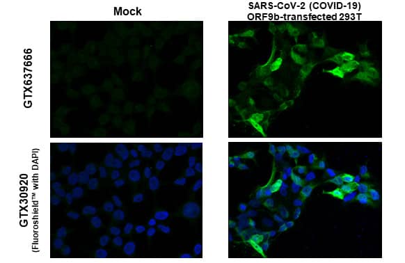 Immunocytochemistry/ Immunofluorescence SARS-CoV-2 ORF9b Antibody (HL1917) - Azide and BSA Free