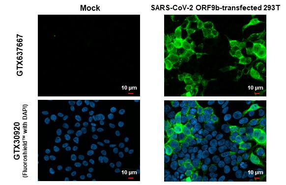 Immunocytochemistry/ Immunofluorescence SARS-CoV-2 ORF9b Antibody (HL1918) - Azide and BSA Free