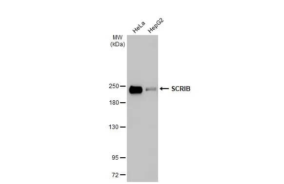 Western Blot: Scribble Antibody (HL1639) - Azide and BSA Free [NBP3-25673] - Various whole cell extracts (30 ug) were separated by 5% SDS-PAGE, and the membrane was blotted with SCRIB antibody [HL1639] (NBP3-25673) diluted at 1:1000. The HRP-conjugated anti-rabbit IgG antibody was used to detect the primary antibody.