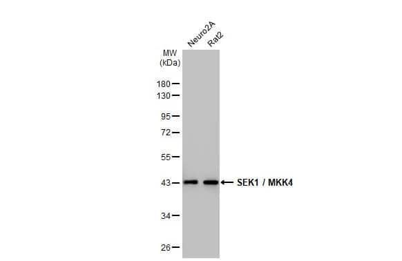 Western Blot: MKK4/MEK4 Antibody (HL1839) - Azide and BSA Free [NBP3-25674] - Various whole cell extracts (30 ug) were separated by 10% SDS-PAGE, and the membrane was blotted with SEK1 / MKK4 antibody [HL1839] (NBP3-25674) diluted at 1:1000. The HRP-conjated anti-rabbit IgG antibody was used to detect the primary antibody.