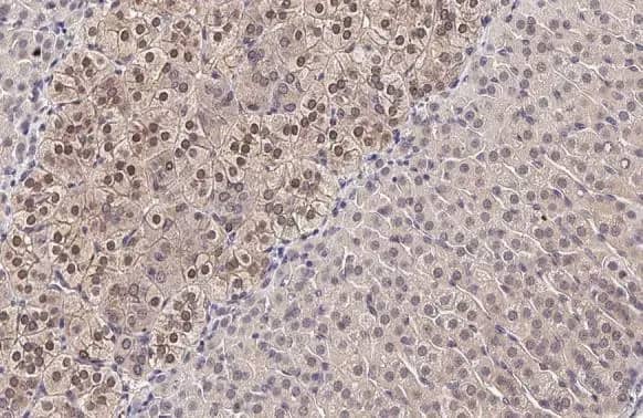 Immunohistochemistry-Paraffin: MKK4/MEK4 Antibody (HL1839) - Azide and BSA Free [NBP3-25674] - SEK1 / MKK4 antibody [HL1839] detects SEK1 / MKK4 protein at cytoplasm and nucleus by immunohistochemical analysis. Sample: Paraffin-embedded mouse adrenal gland. SEK1 / MKK4 stained by SEK1 / MKK4 antibody [HL1839] (NBP3-25674) diluted at 1:50. Antigen Retrieval: Citrate buffer, pH 6.0, 15 min