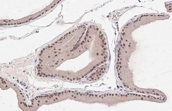 Immunohistochemistry-Paraffin: MKK4/MEK4 Antibody (HL1839) - Azide and BSA Free [NBP3-25674] - SEK1 / MKK4 antibody [HL1839] detects SEK1 / MKK4 protein at cytoplasm and nucleus by immunohistochemical analysis. Sample: Paraffin-embedded rat urinary bladder. SEK1 / MKK4 stained by SEK1 / MKK4 antibody [HL1839] (NBP3-25674) diluted at 1:50. Antigen Retrieval: Citrate buffer, pH 6.0, 15 min