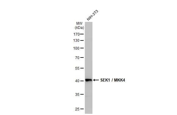 Western Blot: MKK4/MEK4 Antibody (HL1888) - Azide and BSA Free [NBP3-25675] - Whole cell extract (30 ug) was separated by 10% SDS-PAGE, and the membrane was blotted with SEK1 / MKK4 antibody [HL1888] (NBP3-25675) diluted at 1:1000. The HRP-conjugated anti-rabbit IgG antibody was used to detect the primary antibody.