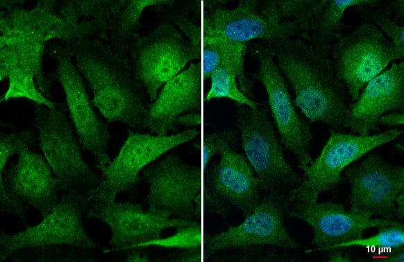 Immunocytochemistry/Immunofluorescence: MKK4/MEK4 Antibody (HL1888) - Azide and BSA Free [NBP3-25675] - SEK1 / MKK4 antibody [HL1888] detects SEK1 / MKK4 protein at cytoplasm and nucleus by immunofluorescent analysis. Sample: HeLa cells were fixed in 4% paraformaldehyde at RT for 15 min. Green: SEK1 / MKK4 stained by SEK1 / MKK4 antibody [HL1888] (NBP3-25675) diluted at 1:500. Blue: Fluoroshield with DAPI .