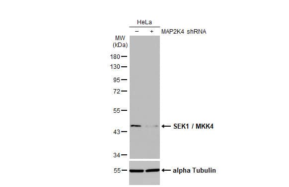 <b>Genetic Strategies Validation. </b>Knockdown Validated: MKK4/MEK4 Antibody (HL1888) - Azide and BSA Free [NBP3-25675] - Untransfected (-) and transfected (+) HeLa whole cell extract (30 ug) were separated by 10% SDS-PAGE, and the membrane was blotted with SEK1 / MKK4 antibody [HL1888] (NBP3-25675) diluted at 1:1000. The HRP-conjugated anti-rabbit IgG antibody was used to detect the primary antibody.