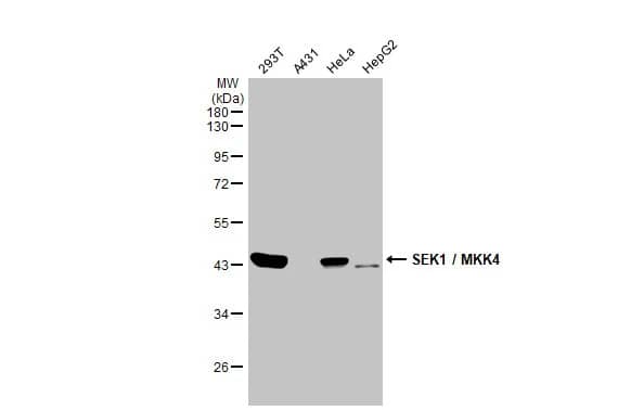 Western Blot: MKK4/MEK4 Antibody (HL1888) - Azide and BSA Free [NBP3-25675] - Various whole cell extracts (30 ug) were separated by 10% SDS-PAGE, and the membrane was blotted with SEK1 / MKK4 antibody [HL1888] (NBP3-25675) diluted at 1:1000. The HRP-conjugated anti-rabbit IgG antibody was used to detect the primary antibody.