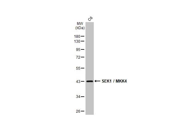 Western Blot: MKK4/MEK4 Antibody (HL1888) - Azide and BSA Free [NBP3-25675] - Whole cell extract (30 ug) was separated by 10% SDS-PAGE, and the membrane was blotted with SEK1 / MKK4 antibody [HL1888] (NBP3-25675) diluted at 1:1000. The HRP-conjugated anti-rabbit IgG antibody was used to detect the primary antibody.