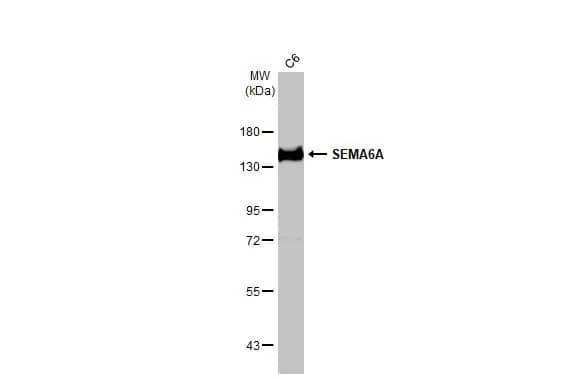 Western Blot: Semaphorin 6A Antibody (HL2120) - Azide and BSA Free [NBP3-25676] - Whole cell extract (30 ug) was separated by 7.5% SDS-PAGE, and the membrane was blotted with SEMA6A antibody [HL2120] (NBP3-25676) diluted at 1:1000. The HRP-conjugated anti-rabbit IgG antibody was used to detect the primary antibody, and the signal was developed with Trident ECL plus-Enhanced.