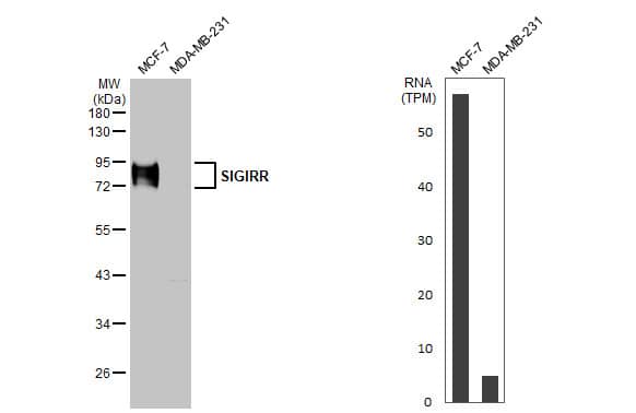 Western Blot: SIGIRR Antibody (HL2008) - Azide and BSA Free [NBP3-25681] - Various whole cell extracts (30 ug) were separated by 10% SDS-PAGE, and the membrane was blotted with SIGIRR antibody [HL2008] (NBP3-25681) diluted at 1:1000. The HRP-conjugated anti-rabbit IgG antibody was used to detect the primary antibody. Corresponding RNA expression data for the same cell lines are based on Human Protein Atlas program.