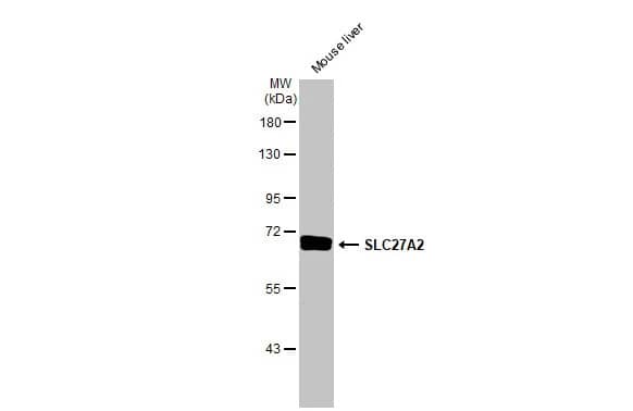 Western Blot: FATP2/SLC27A2 Antibody (HL2232) - Azide and BSA Free [NBP3-25687] - Mouse tissue extract (50 ug) was separated by 7.5% SDS-PAGE, and the membrane was blotted with SLC27A2 antibody [HL2232] (NBP3-25687) diluted at 1:1000. The HRP-conjugated anti-rabbit IgG antibody was used to detect the primary antibody.