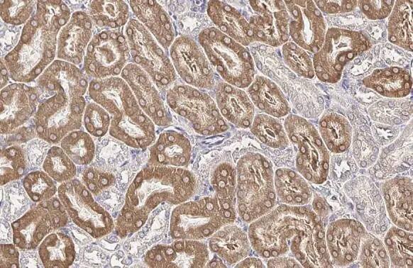 Immunohistochemistry-Paraffin: FATP2/SLC27A2 Antibody (HL2232) - Azide and BSA Free [NBP3-25687] - SLC27A2 antibody [HL2232] detects SLC27A2 protein at cell membrane and cytoplasm by immunohistochemical analysis. Sample: Paraffin-embedded mouse kidney. SLC27A2 stained by SLC27A2 antibody [HL2232] (NBP3-25687) diluted at 1:100. Antigen Retrieval: Citrate buffer, pH 6.0, 15 min